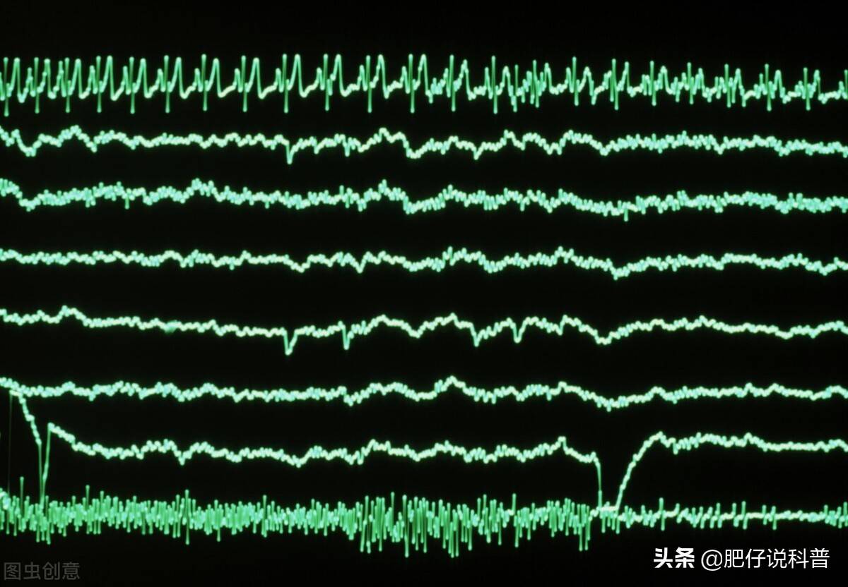 睡觉为什么会做梦，是利还是弊，你能记住梦的内容吗