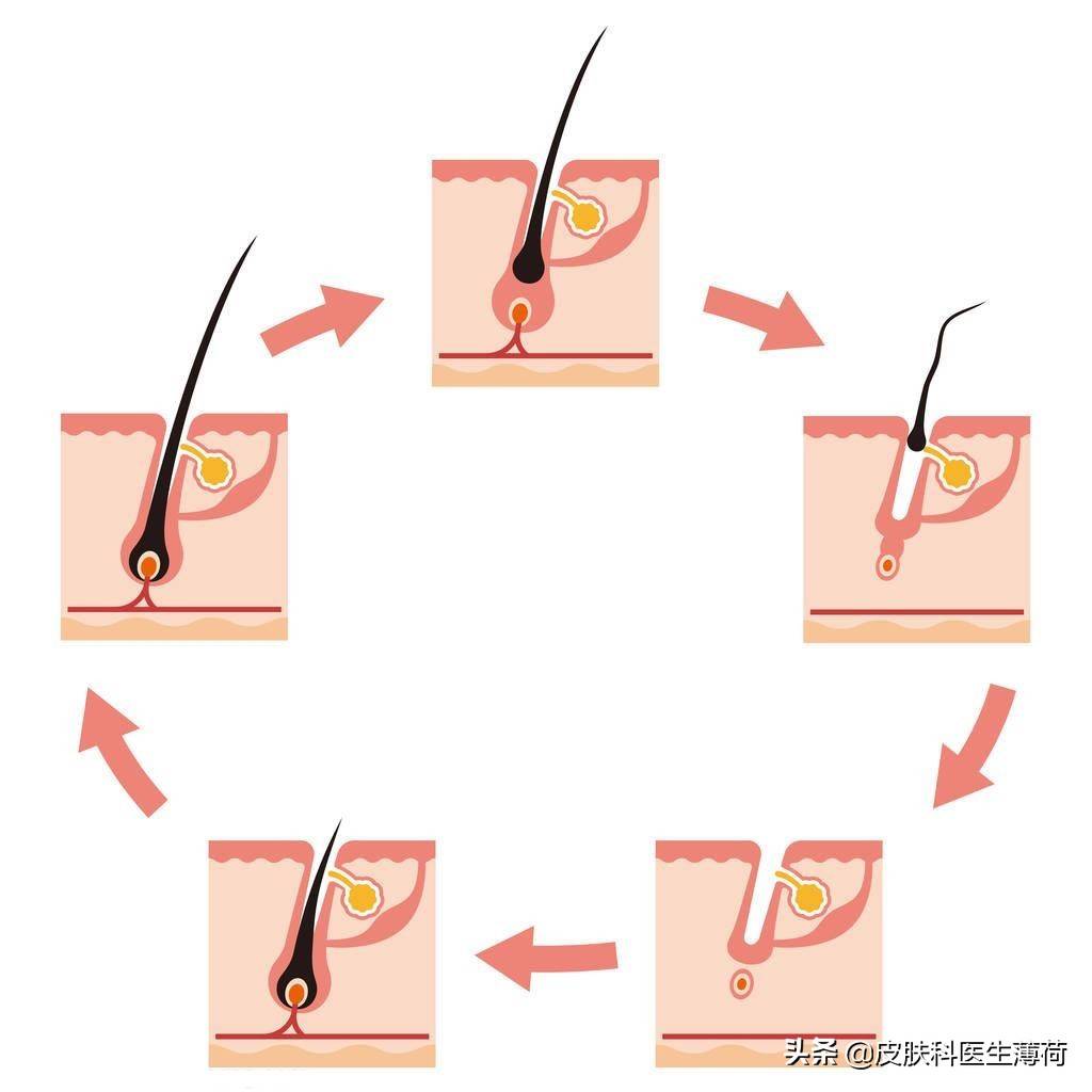 脱发｜原来掉头发的原因是这些