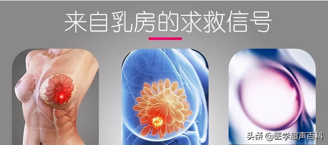 青睐女性的乳腺肿瘤，你知道多少？还能无视多久？