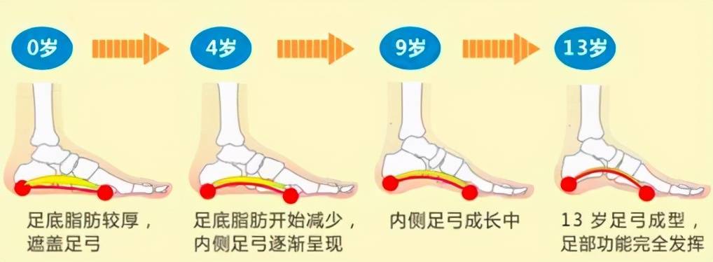 扁平足——有一种痛叫做“脚踏实地”的痛