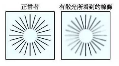 眼睛散光要戴眼镜吗？学会这三种方法，症状轻松改善