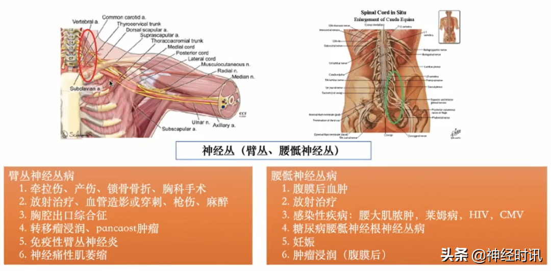 周围神经病的九大诊断步骤，请查收