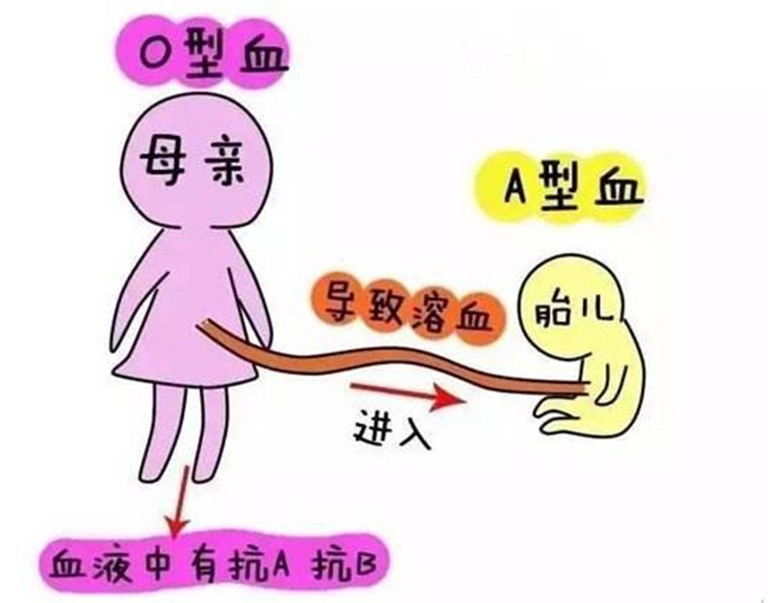 孕妈如果是这两种血型，第一胎最好“保住”，这对你很重要