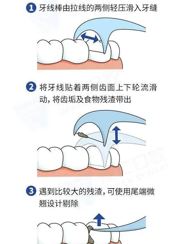 什么牙线你还不会用？给我去学