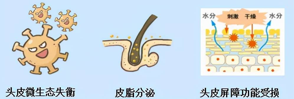洗发水都搞不定的头皮屑，还能抢救一下吗？