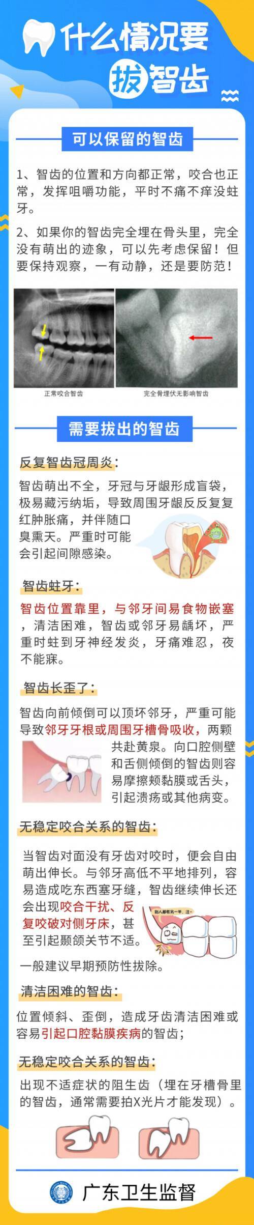 别人拔智齿花400，你却花了1500？关于智齿，你关心的6点疑问