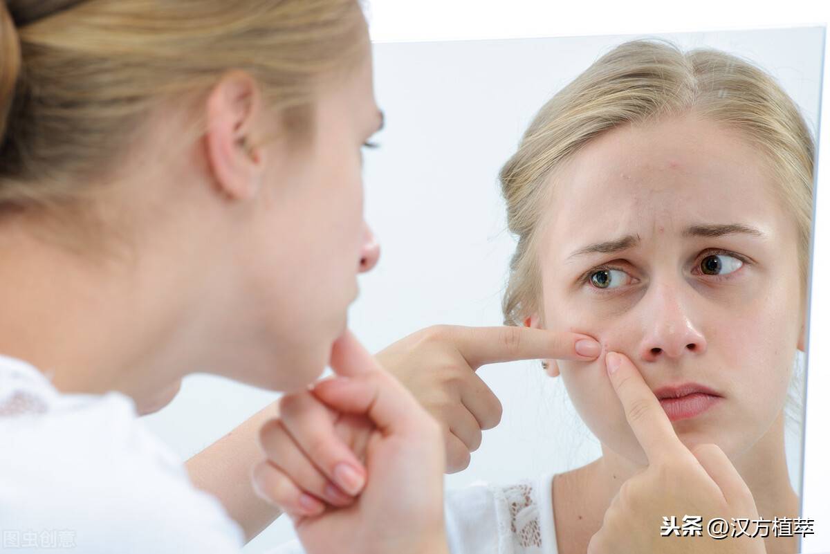 盘点脸上不同部位长痘的原因