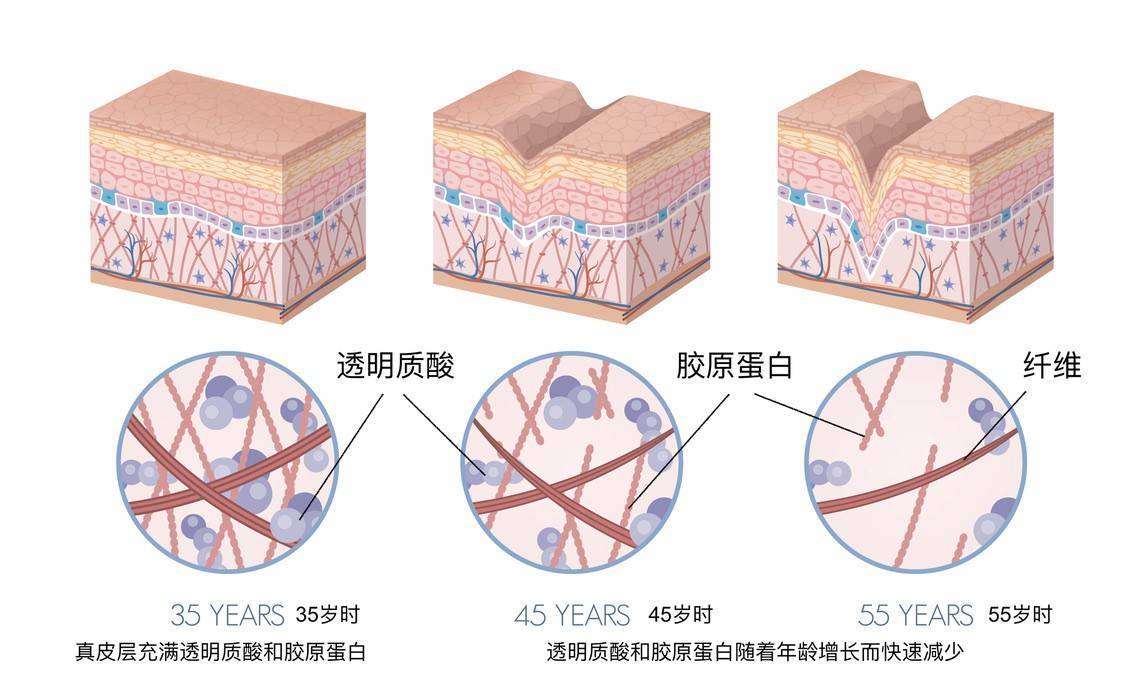 美颜秘笈 – 透明质酸（玻尿酸）的种种说法