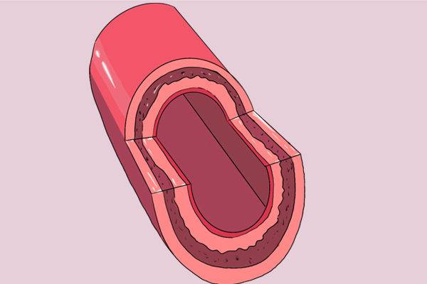 莫名出现手抖，暗示哪些问题？
