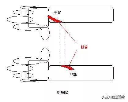 大家去看病号脉时需要注意的，影响正常号脉时的原因都有什么？