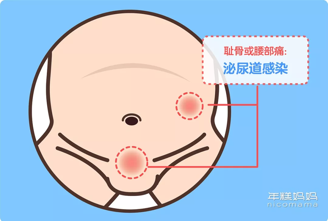 宝宝老喊肚子疼？哪种情况需要看医生？一根手指教你判断