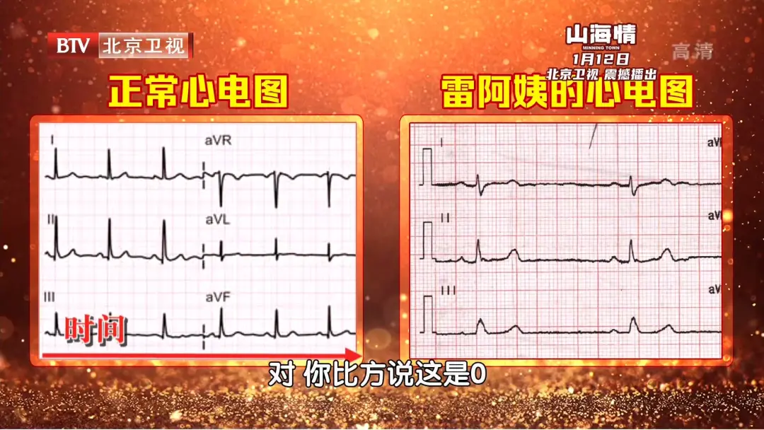 心跳过慢、过快、乱跳，都是因为它出了问题！一个小方法，提早发现危机