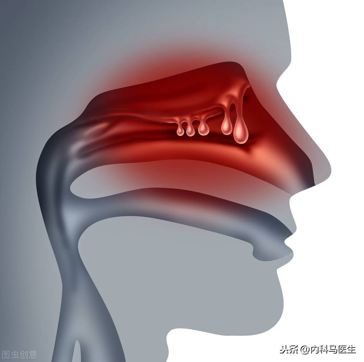 物理疗法！不吃药不打针就可以治疗和预防鼻炎