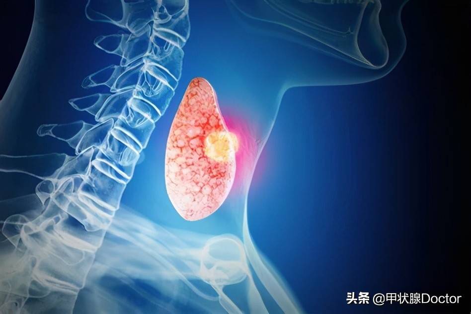 甲状腺问题该找哪个科室看？这篇文章可让你少走弯路，少花冤枉钱