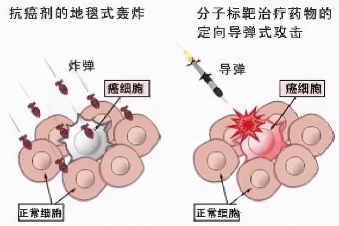 肺癌患者如何看懂病理报告？