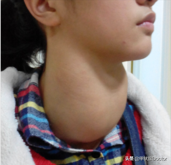 甲状腺问题该找哪个科室看？这篇文章可让你少走弯路，少花冤枉钱