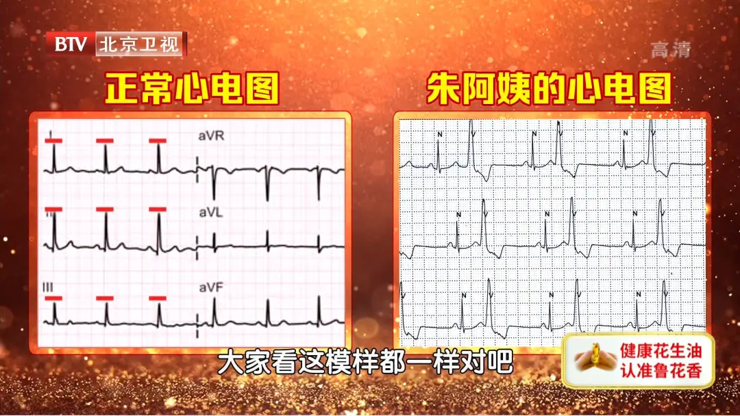 心跳过慢、过快、乱跳，都是因为它出了问题！一个小方法，提早发现危机