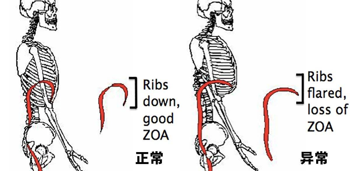 “肋骨外翻”不可怕：找准成因，强力修正