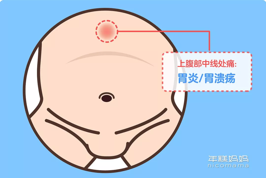 宝宝老喊肚子疼？哪种情况需要看医生？一根手指教你判断