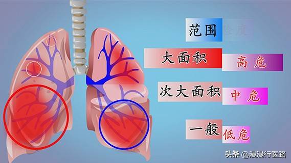 关于肺血栓栓塞症你了解多少呢？第一步先从预防做起