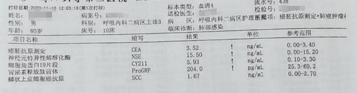 靶向药是肺癌病人的“救命稻草”，目前有哪些选择？一文列全了