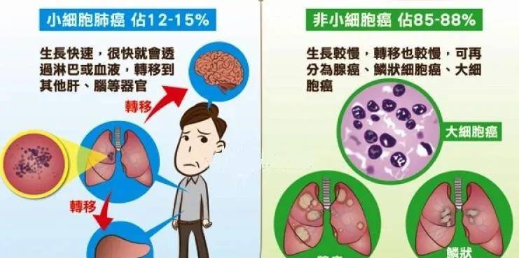 肺癌患者如何看懂病理报告？