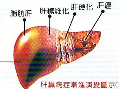 2种植物捣碎泡水喝15天，肝脏毒素都吓跑，肝炎不敢造次