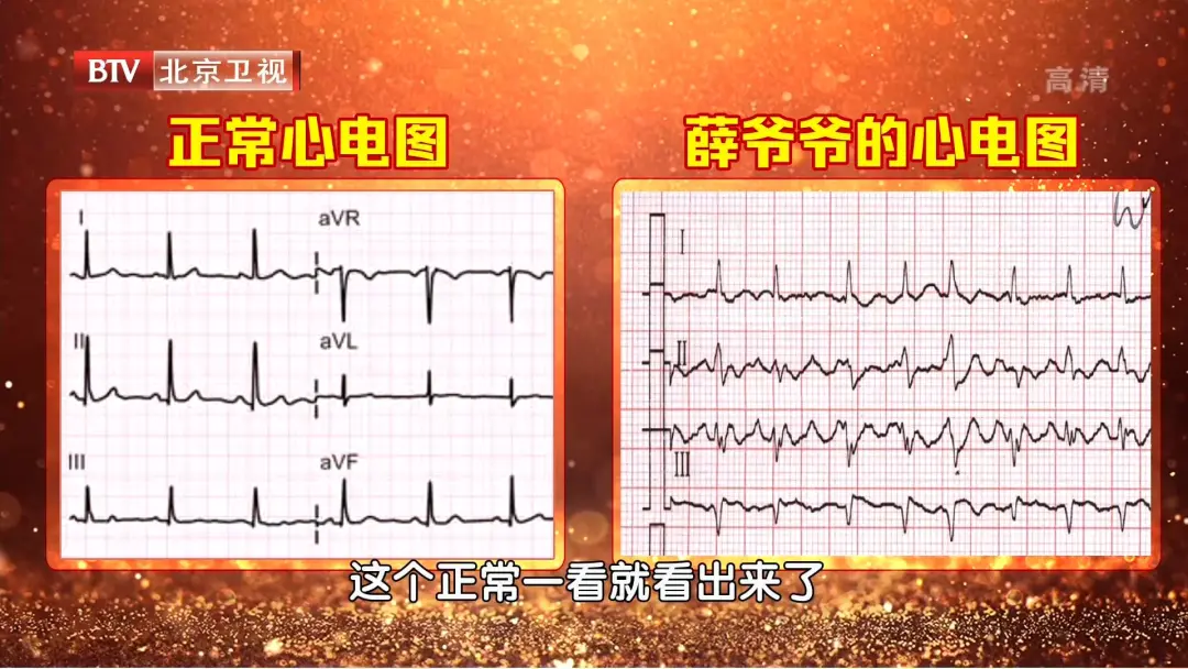 心跳过慢、过快、乱跳，都是因为它出了问题！一个小方法，提早发现危机