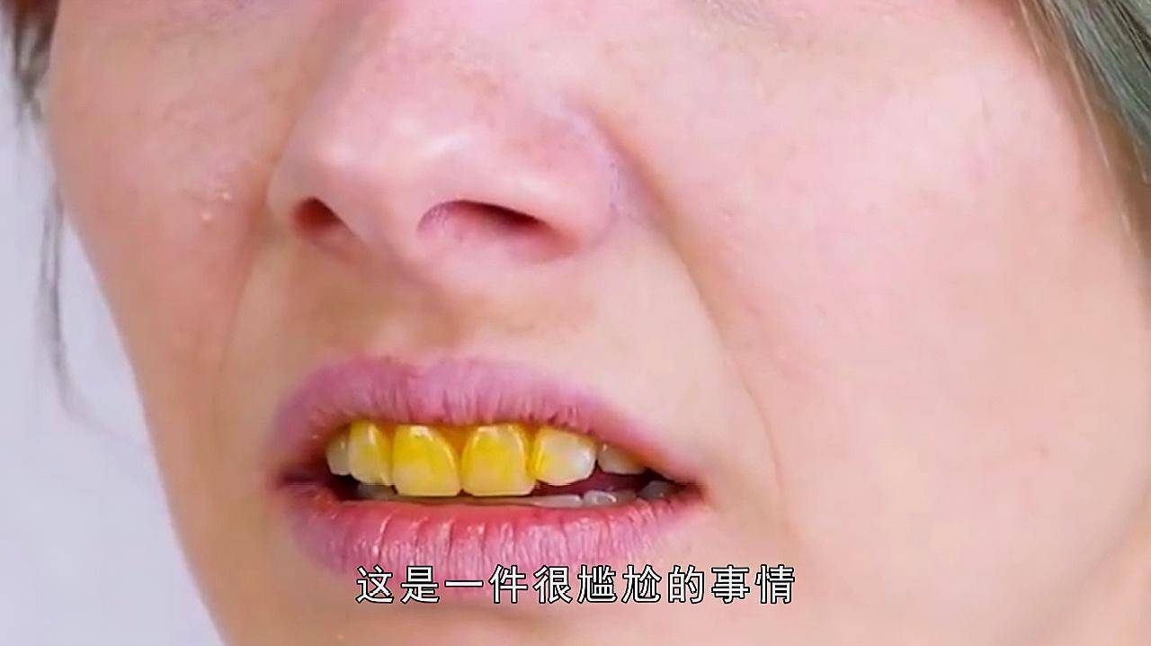 牙黄怎么办？牙齿美白，压箱底的三个秘籍告诉你