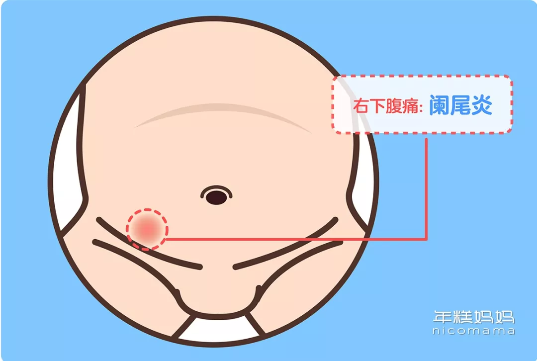 宝宝老喊肚子疼？哪种情况需要看医生？一根手指教你判断