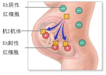 Rh血型系统探秘之旅（一）——“熊猫血”到底是什么？