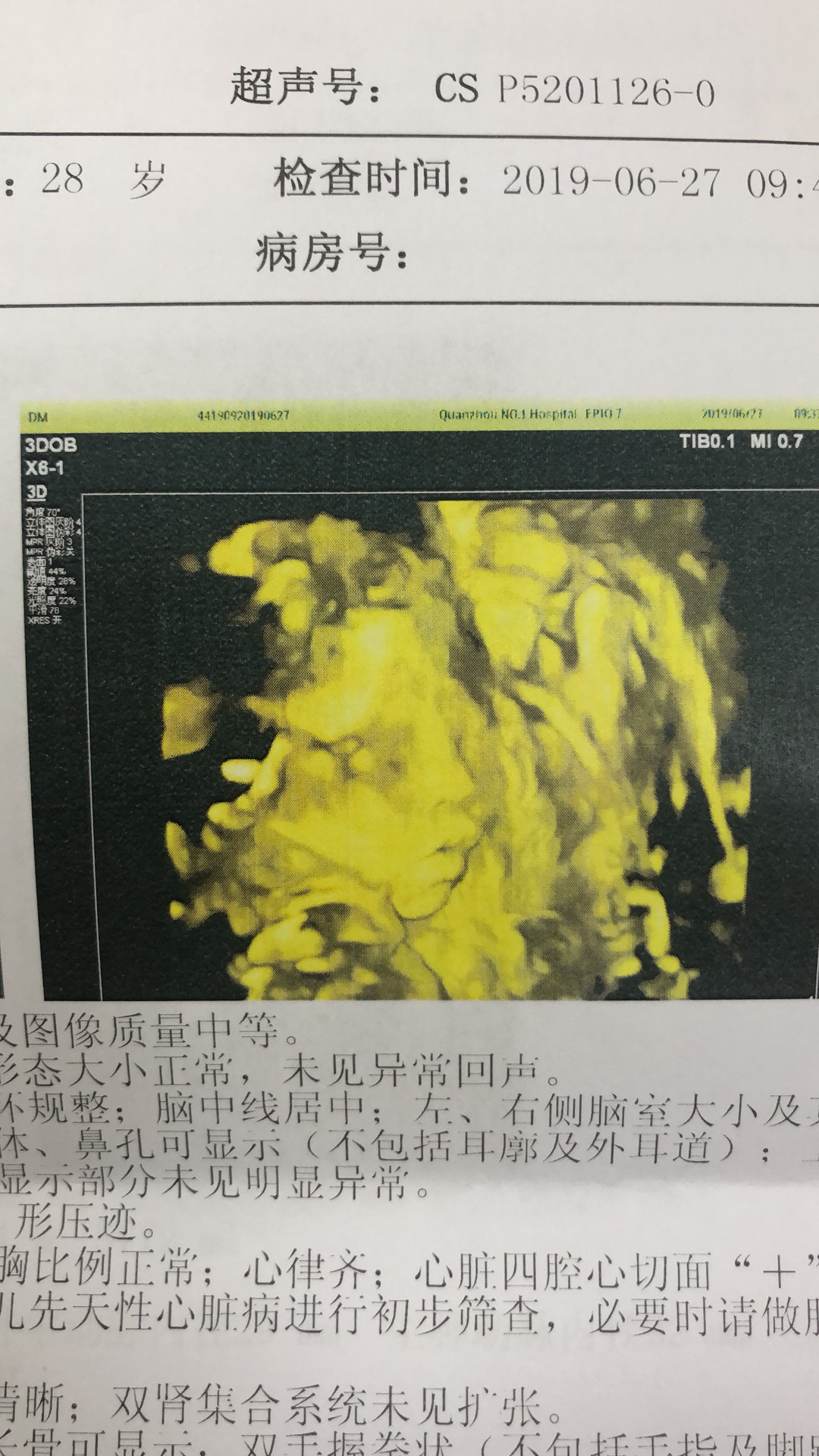 结婚三年，需要注意的事