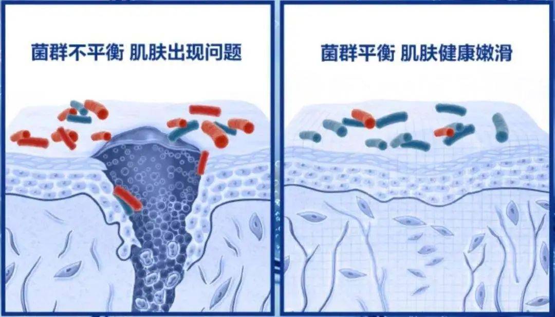 不到300，搞定秋敏肌肤作妖