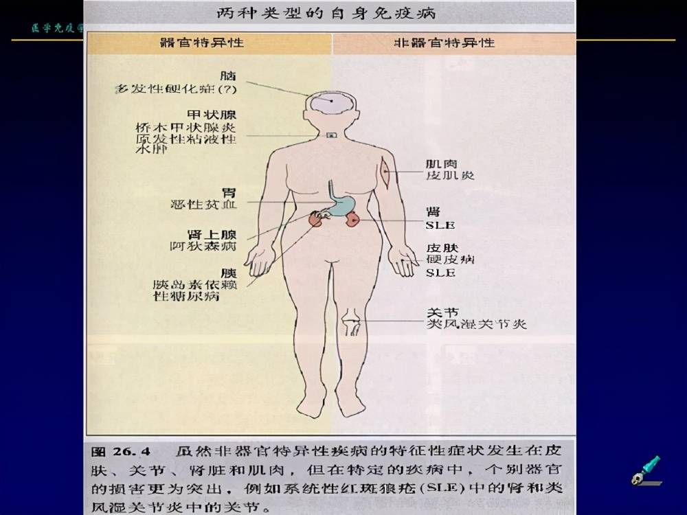 干燥综合征即舍格伦综合征，以神经损伤为主，如周围神经病变等