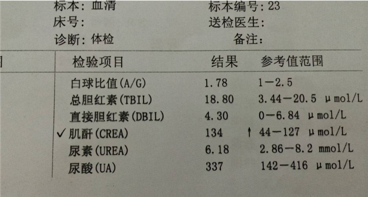 肌酐正常肾就正常吗？这些关于肌酐的问题，医生为您讲清楚