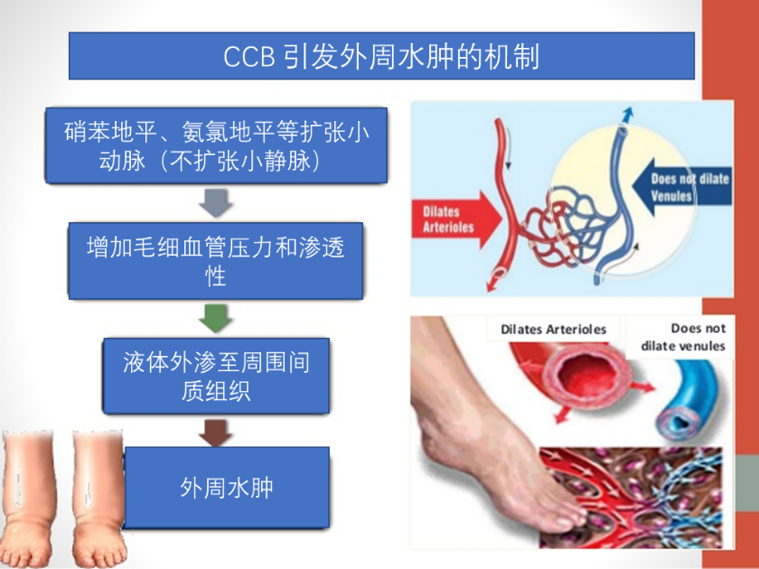 双下肢水肿？医生：你可能正在吃这些药物