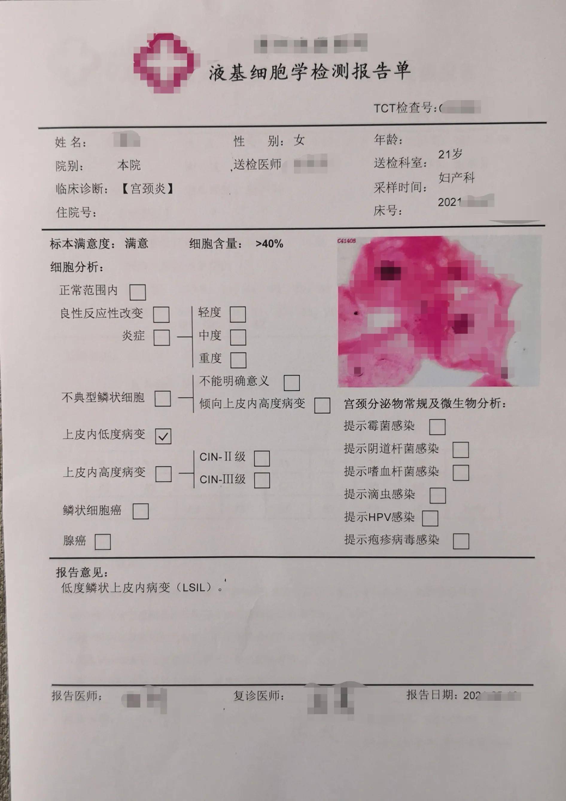 今天这三张病理报告提醒：HPV16和HPV18阳性，一定要引起重视