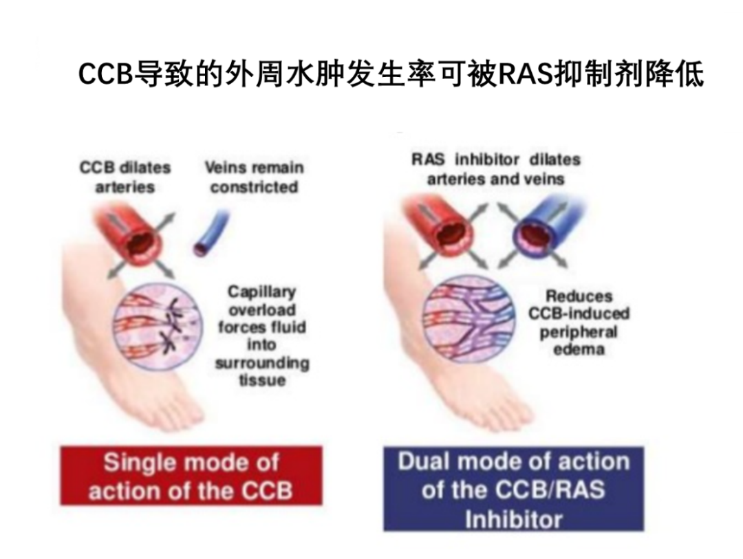 双下肢水肿？医生：你可能正在吃这些药物