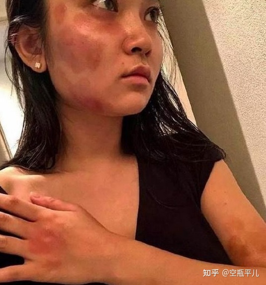 原谅家暴，就等于将自己推入深渊，女人，清醒一点