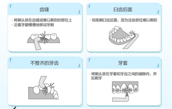 牙齿也需要好好呵护，冲牙器排行榜给你最佳的选择