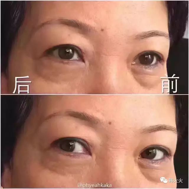 refa眼部按摩仪怎么样（最新refa眼部美容仪使用方法）