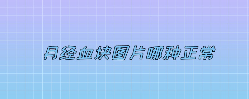 月经血块图片哪种正常