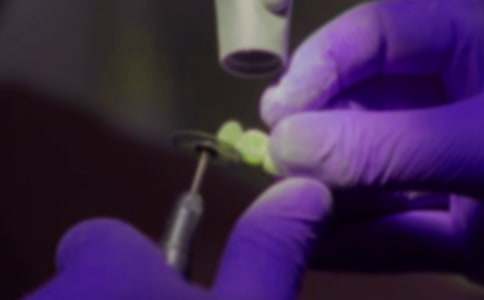 别怕拔牙会影响记忆力