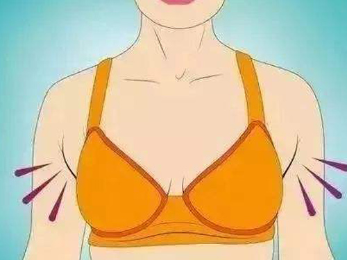 副乳是怎么形成的
