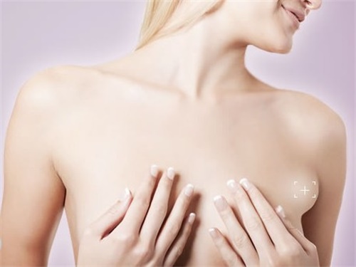 腋下副乳怎么消除