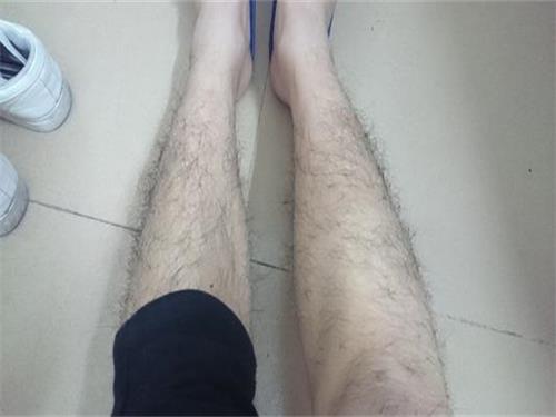 女生腿毛怎么除