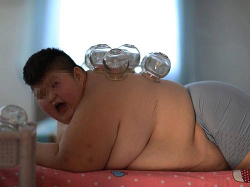 小孩肾虚怎么调理

