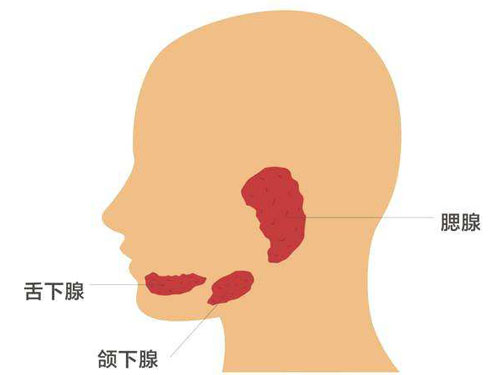 腮腺炎的早期症状