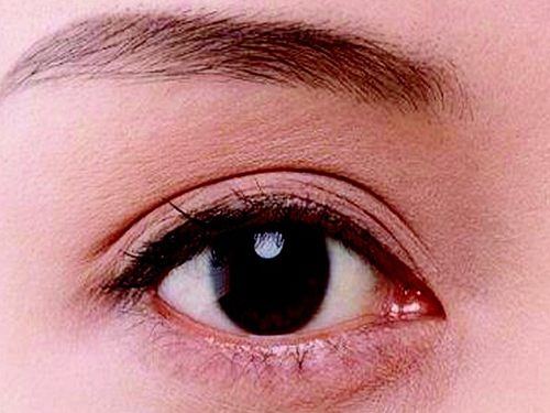 眼睑水肿是什么样子